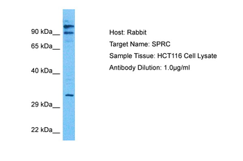 SPARC Rabbit Polyclonal Antibody