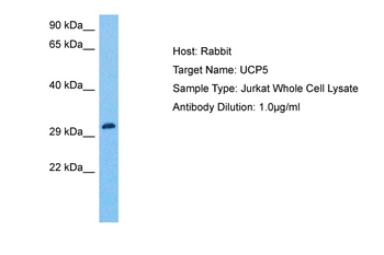 SLC25A14 Rabbit Polyclonal Antibody