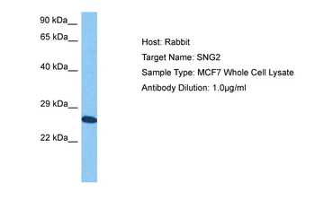 SYNGR2 Rabbit Polyclonal Antibody