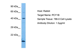 PCYT1B Rabbit Polyclonal Antibody