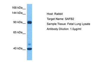 SAFB2 Rabbit Polyclonal Antibody