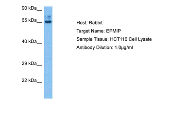 EPM2AIP1 Rabbit Polyclonal Antibody