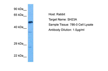 SH2D3A Rabbit Polyclonal Antibody