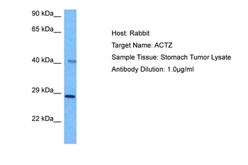 ACTR1A Rabbit Polyclonal Antibody