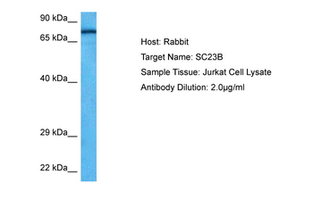SEC23B Rabbit Polyclonal Antibody