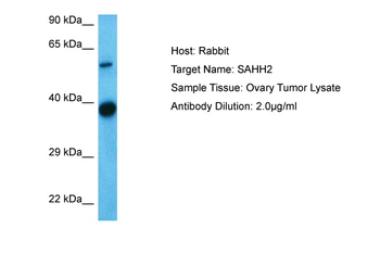 AHCYL1 Rabbit Polyclonal Antibody