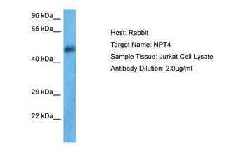 SLC17A3 Rabbit Polyclonal Antibody