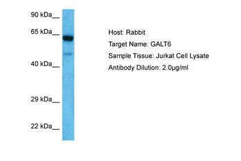 GALNT6 Rabbit Polyclonal Antibody