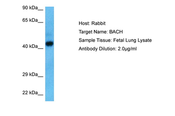 ACOT7 Rabbit Polyclonal Antibody