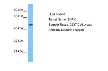 SHPK Rabbit Polyclonal Antibody