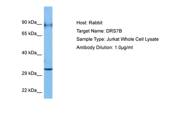 DHRS7B Rabbit Polyclonal Antibody