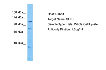 SLITRK5 Rabbit Polyclonal Antibody