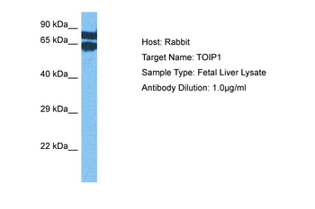 TOR1AIP1 Rabbit Polyclonal Antibody