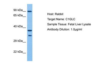C1GALT1C1 Rabbit Polyclonal Antibody