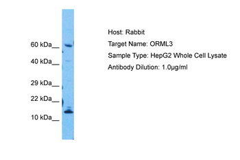 ORMDL2 Rabbit Polyclonal Antibody