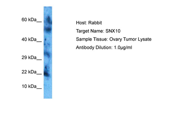 SNX10 Rabbit Polyclonal Antibody