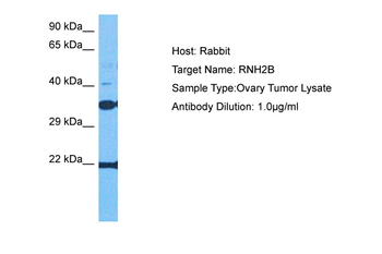 RNASEH2B Rabbit Polyclonal Antibody