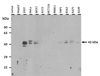 TIAL1 Rabbit Polyclonal Antibody