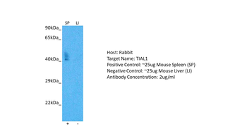 TIAL1 Rabbit Polyclonal Antibody