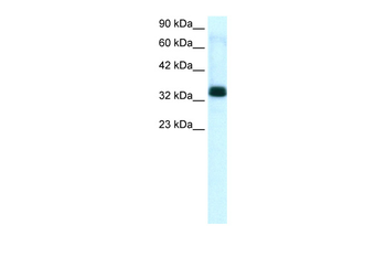 TIAL1 Rabbit Polyclonal Antibody