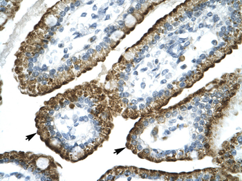 GABRP Rabbit Polyclonal Antibody