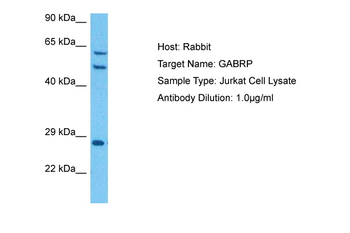 GABRP Rabbit Polyclonal Antibody
