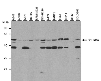GABRP Rabbit Polyclonal Antibody