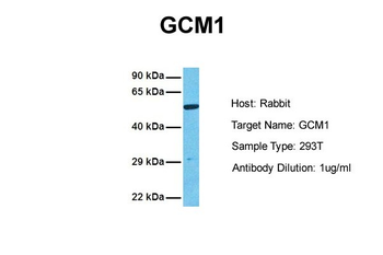 GCM1 Rabbit Polyclonal Antibody