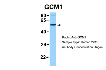 GCM1 Rabbit Polyclonal Antibody