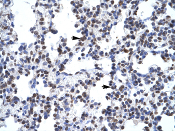 GCM1 Rabbit Polyclonal Antibody
