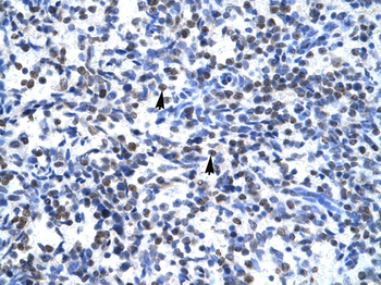 GCM1 Rabbit Polyclonal Antibody