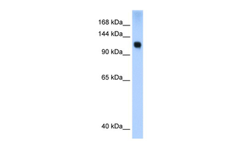 SMARCA5 Rabbit Polyclonal Antibody
