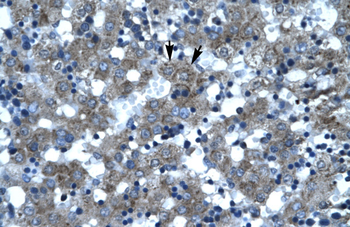 SUPT3H Rabbit Polyclonal Antibody