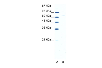 FOXN1 Rabbit Polyclonal Antibody