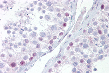 UTF1 Rabbit Polyclonal Antibody
