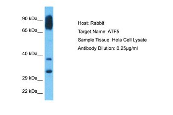 ATF5 Rabbit Polyclonal Antibody