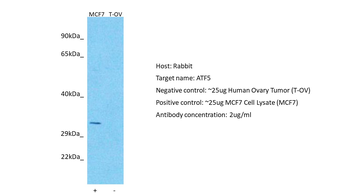 ATF5 Rabbit Polyclonal Antibody