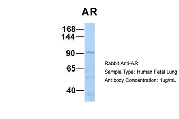 AR Rabbit Polyclonal Antibody