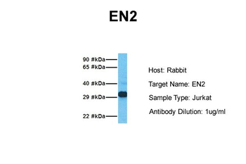 EN2 Rabbit Polyclonal Antibody