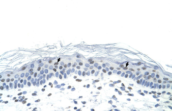 FOSL1 Rabbit Polyclonal Antibody