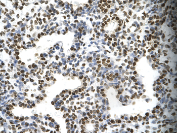 FOSL1 Rabbit Polyclonal Antibody
