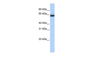 SLC34A3 Rabbit Polyclonal Antibody