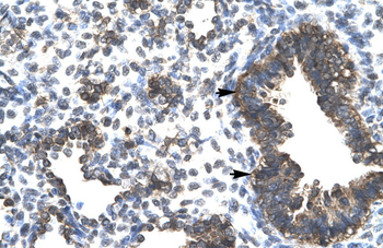 ESRRG Rabbit Polyclonal Antibody