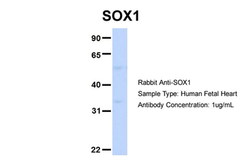 SOX1 Rabbit Polyclonal Antibody