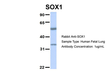 SOX1 Rabbit Polyclonal Antibody