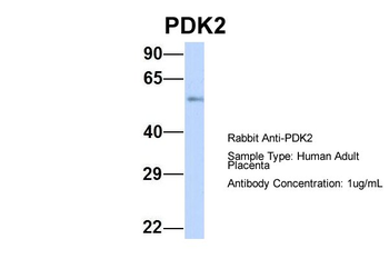 PDK1 Rabbit Polyclonal Antibody