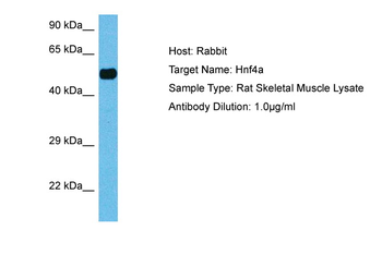 HNF4A Rabbit Polyclonal Antibody