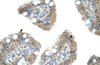 NAB1 Rabbit Polyclonal Antibody