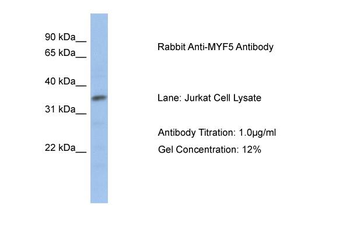 MYF5 Rabbit Polyclonal Antibody