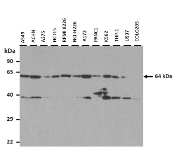 SLC34A3 Rabbit Polyclonal Antibody